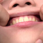 『フェチ』 歯観察レズ 安達まどか・日向小夏 「DUGA」