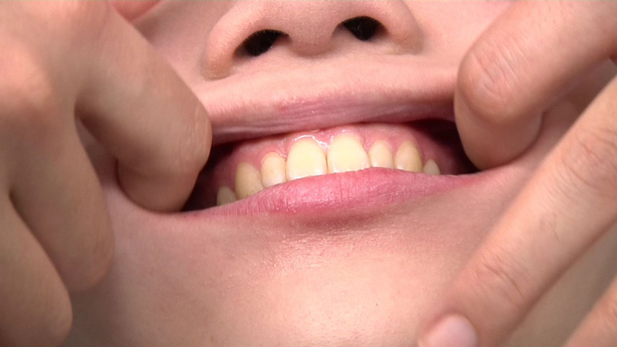 『フェチ』 歯観察レズ 安達まどか・日向小夏 「DUGA」