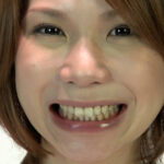 『フェチ』 歯06 「DUGA」