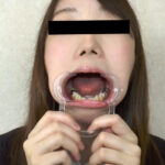 『フェチ』 歯、痛いですか？ 素人娘たちの意識調査 「DUGA」