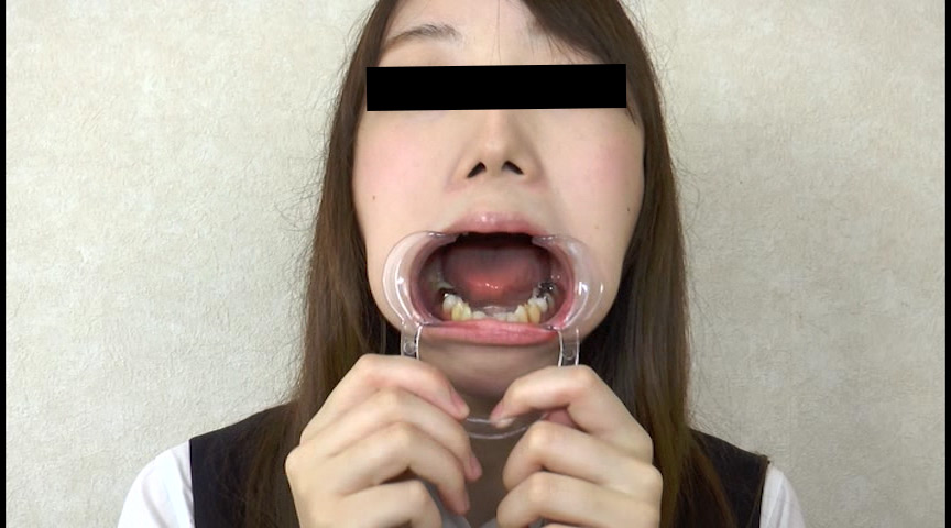 『フェチ』 歯、痛いですか？ 素人娘たちの意識調査 「DUGA」