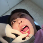 『フェチ』 歯フェチ！本物歯治療映像色素沈着研磨除去＆歯石除去 「DUGA」