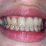 『フェチ』 実はエッチな近所のお姉さんの歯観察 香苗レノン 「DUGA」