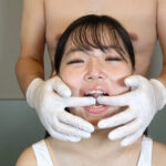 『フェチ』 鼻フック＆開口器顔面デストロイお遊戯会●前編 「DUGA」