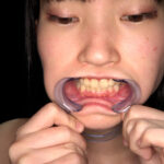 『フェチ』 【歯・口腔】ドM女子の口内・歯・のどちんこ観察★ 「DUGA」