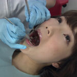 『フェチ』 歯フェチ！処置室 ゆうこちゃん 銀歯がキラリ 「DUGA」