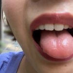 『フェチ』 街角で声をかけて口内観察させてもらう さつきちゃん 「DUGA」