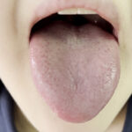 『フェチ』 街角で声をかけて口内観察させてもらう りかちゃん 「DUGA」