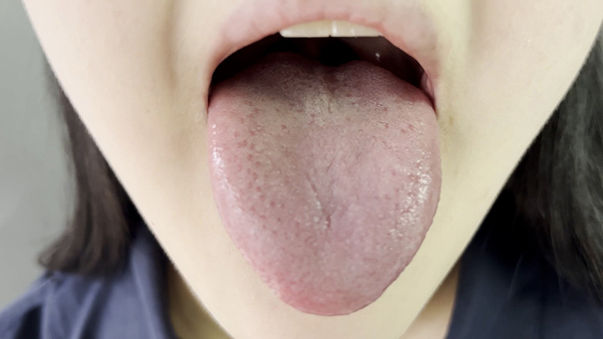 『フェチ』 街角で声をかけて口内観察させてもらう りかちゃん 「DUG...