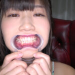 『フェチ』 須崎美羽チャンの激レア歯口内観察＆涎垂らし電マ当て！ 「DUGA」