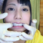 『フェチ』 新口腔内観察 - TSUKINO by 口腔仙人（Dr. X） 「DUGA」