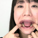 『フェチ』 歯フェチ！レア美熟女の銀歯観察 優奈 「DUGA」