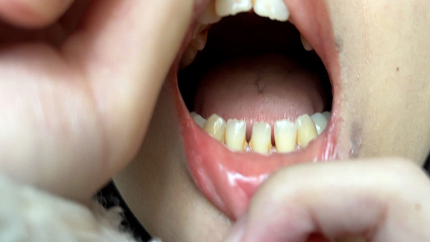 『フェチ』 街角で声をかけて口内観察させてもらう あむちゃん 「DUG...