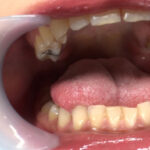 『フェチ』 歯フェチ＆マヨネーズ咀嚼 「DUGA」