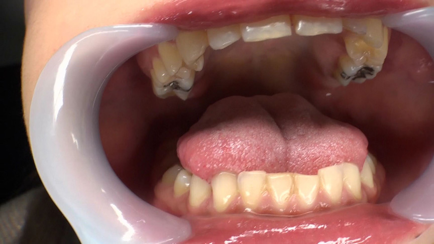 『フェチ』 歯フェチ＆マヨネーズ咀嚼 「DUGA」