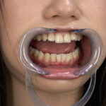 『フェチ』 歯05 「DUGA」