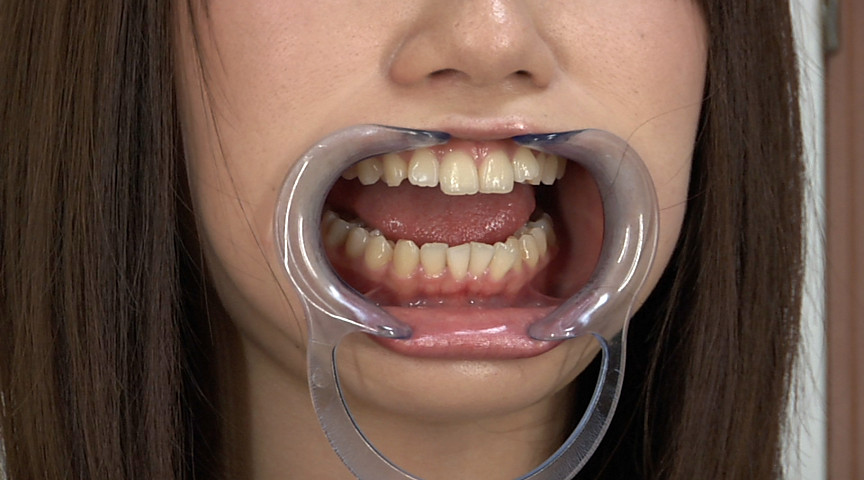 『フェチ』 歯05 「DUGA」