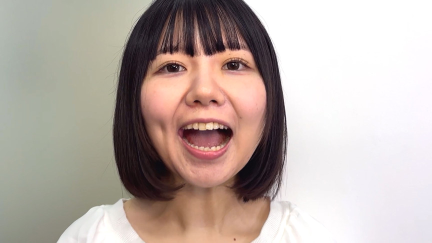『フェチ』 街角で声をかけて口内観察させてもらう みゆりちゃん 「DU...