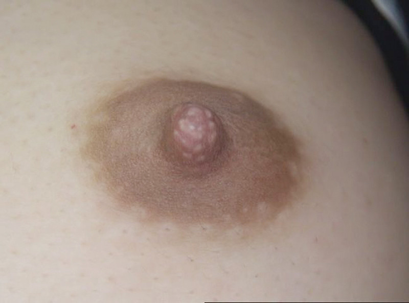 『フェチ』 100人の乳首 第11集 「DUGA」