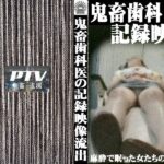 ＜盗撮＞ 巨乳患者を狙う！鬼畜歯科医の盗撮記録 『FANZA』