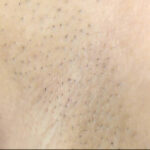 ＜素人＞ 300人の腋 2 『FANZA』