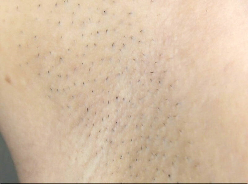 ＜素人＞ 300人の腋 2 『FANZA』