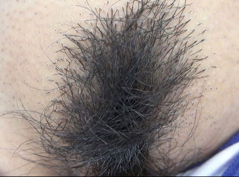 ＜素人＞ 300人のまん毛3 『FANZA』