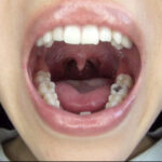 ＜素人＞ 300人のおくち 3 『FANZA』