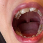 ＜素人＞ 【特価】口腔観察VOL.1 8名150分お買い得セット 『FANZA』